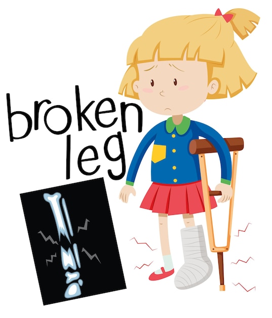 Free clip broken leg cartoons, Download Free clip broken leg cartoons ...