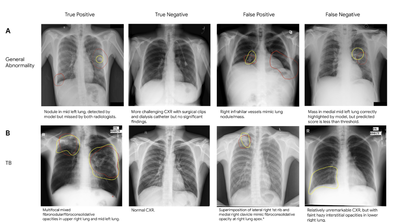 Free clip chest xrays, Download Free clip chest xrays png images, Free ...