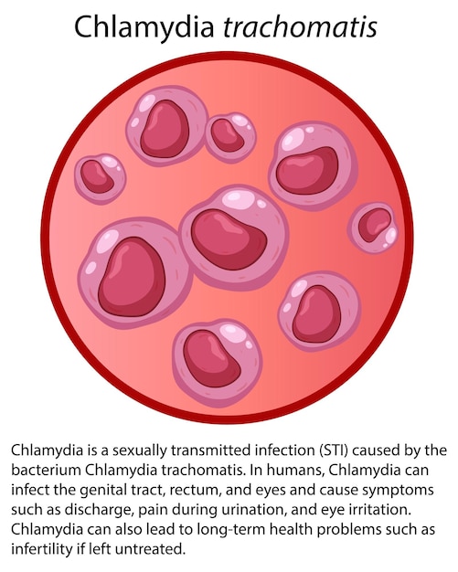 Free Vector | Chlamydia trachomatis with explanation - Clip Art Library